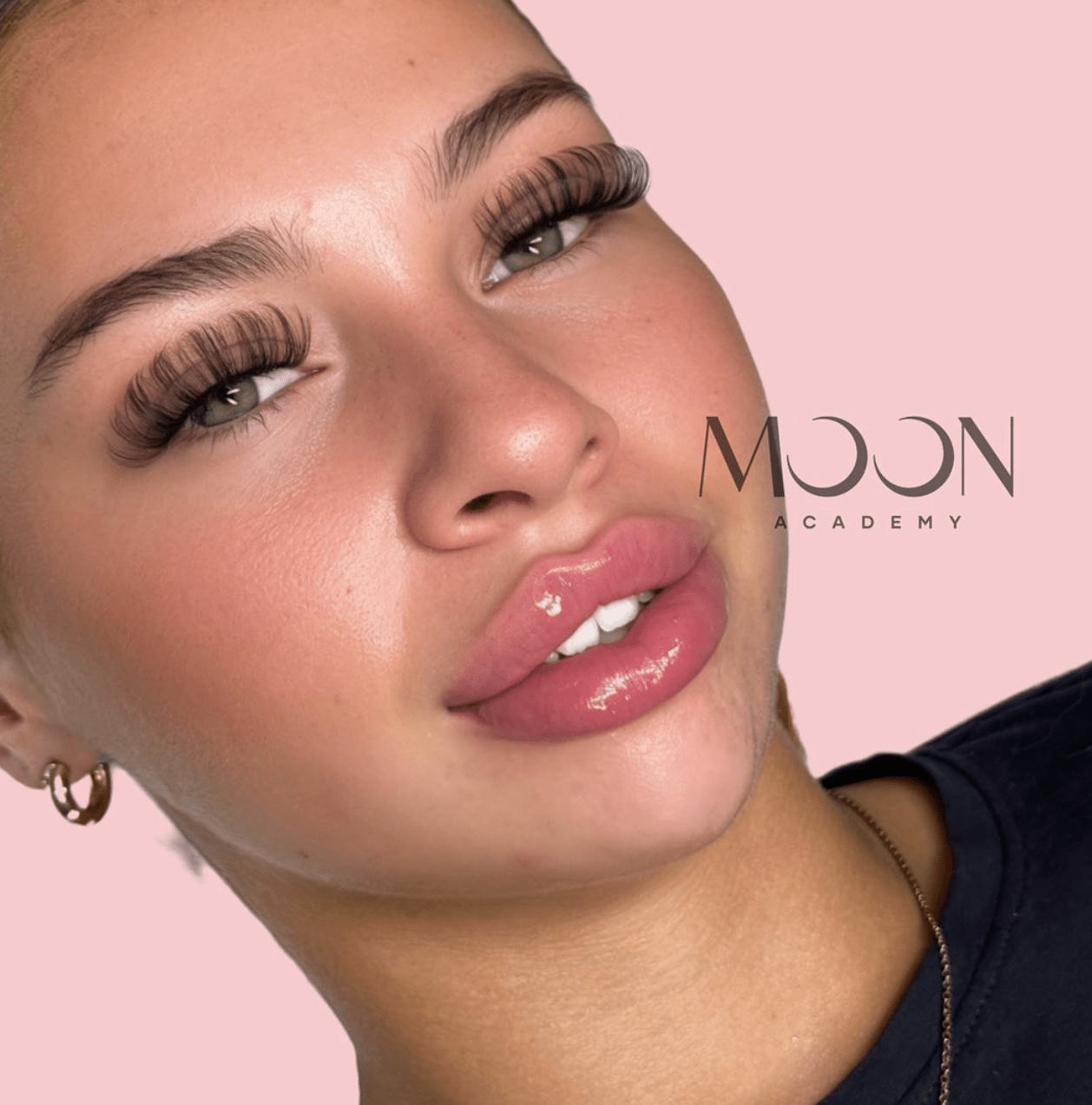 Lip filler techniques - Moon Aesthetics Academy